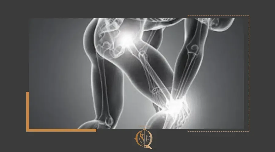 أعراض عرق النسا عند النساء